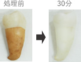 処理前-30分後